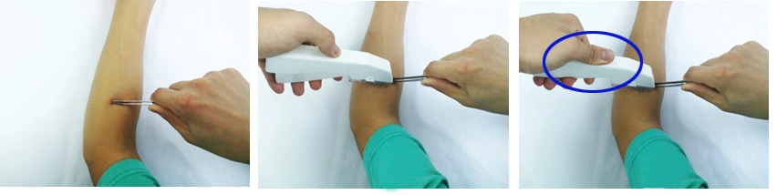 Μίας χρήσης ιατρικά χειρουργικά Staplers δερμάτων και Stapler Removers με το CE